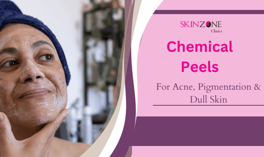 Chemical Peels for Acne, Pigmentation & Dull Skin: The Modern Dermatology Secret