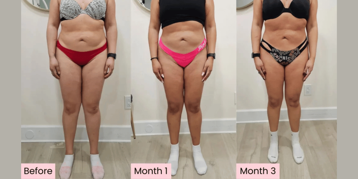 expected-results-from-ozempic-weight-loss-treatment