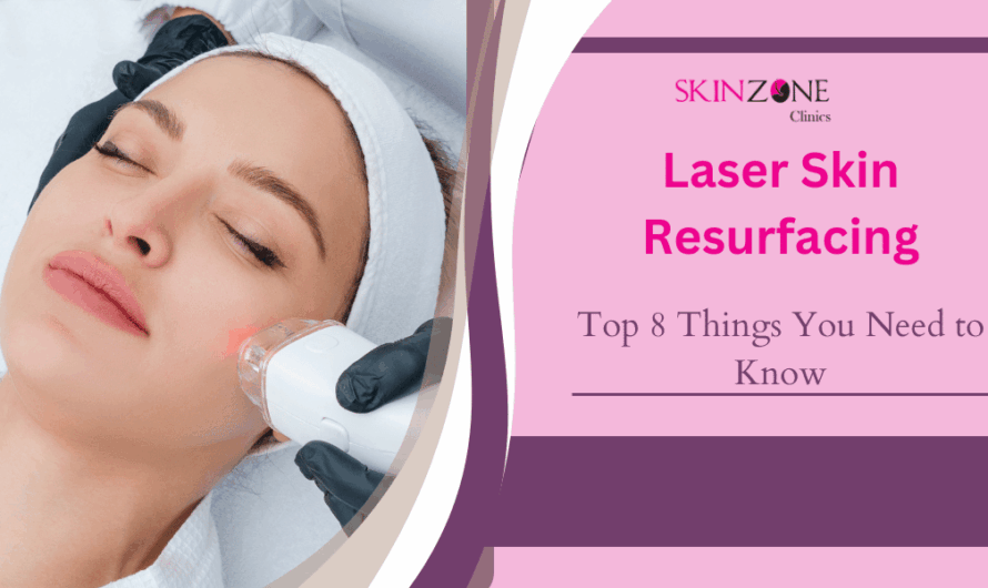 Laser Skin Resurfacing: Top 8 Things You Need to Know