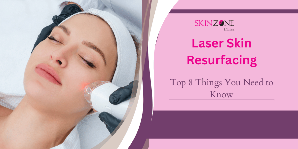 Laser Skin Resurfacing: Top 8 Things You Need to Know