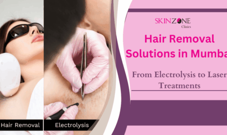 Hair Removal Solutions in Mumbai: From Electrolysis to Laser Treatments