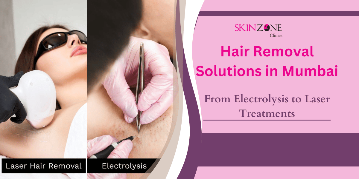 Hair Removal Solutions in Mumbai: From Electrolysis to Laser Treatments