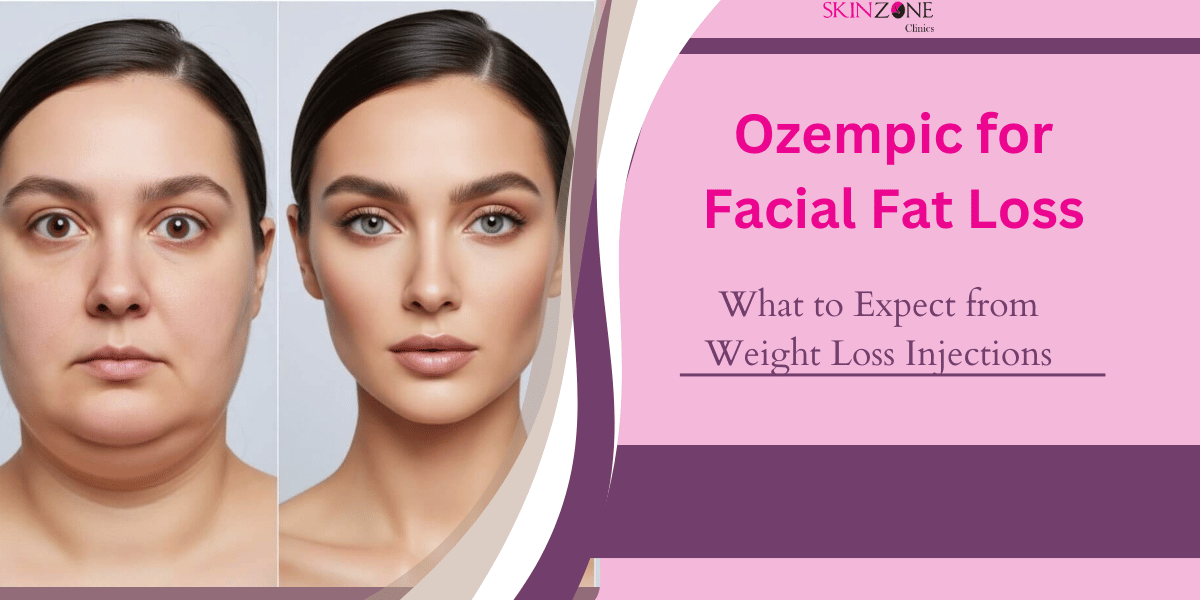 Ozempic for Facial Fat Loss